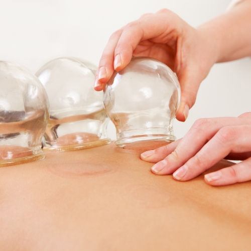 cupping-Rehab-Partners-of-Gadsden-Gadsden-AL